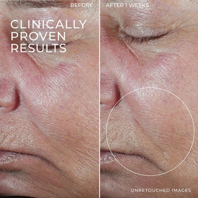 RoC Derm Correxion Retinol Face Stick - Missing Box