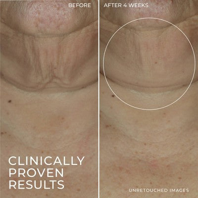 RoC Derm Correxion Retinol Face Stick - Missing Box