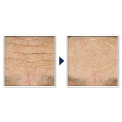 RoC Face & Neck Anti-Aging Moisturizer Firming Cream for Crepey Skin 1.7 fl oz - Imperfect Box