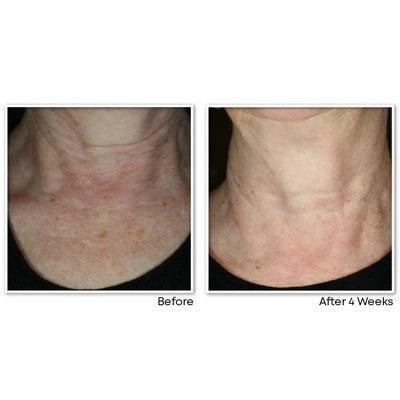 RoC Face & Neck Anti-Aging Moisturizer Firming Cream for Crepey Skin 1.7 fl oz - Imperfect Box