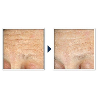 RoC Face & Neck Anti-Aging Moisturizer Firming Cream for Crepey Skin 1.7 fl oz - Imperfect Box