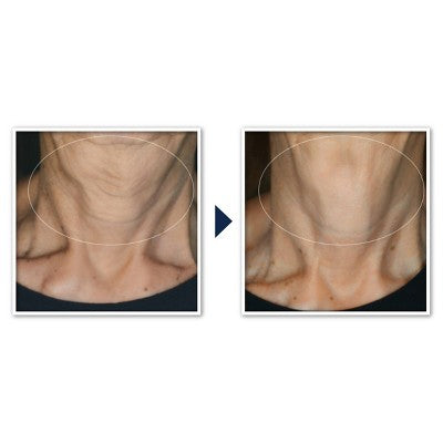 RoC Face & Neck Anti-Aging Moisturizer Firming Cream for Crepey Skin 1.7 fl oz - Imperfect Box