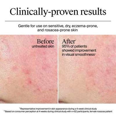 Neutrogena Hydro Boost Water Face Cream for Extra-Dry and Acne-Prone Skin 1.7 fl oz - Imperfect Box