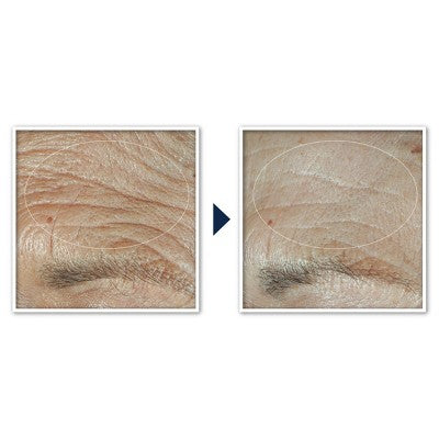 RoC Face & Neck Anti-Aging Moisturizer Firming Cream for Crepey Skin 1.7 fl oz - Imperfect Box